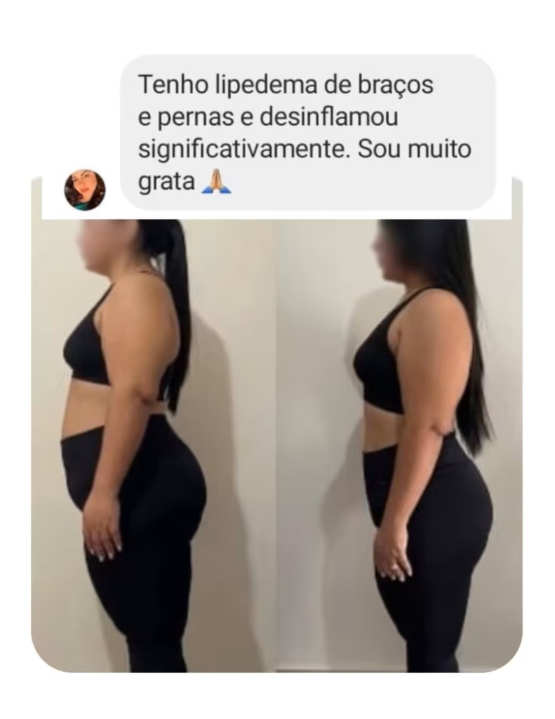 foto de resultado